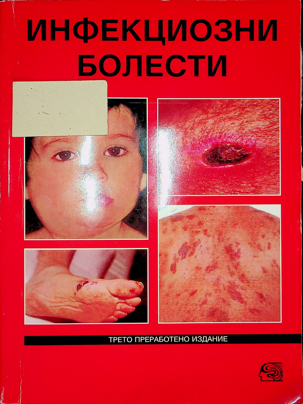 Инфекциозни болести